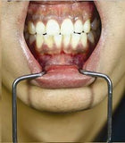 Dental Orringer Lip Wider, Small / Child Size - Osung USA