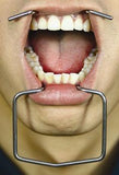 Dental Orringer Lip Wider, Small / Child Size - Osung USA
